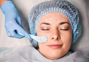 Radical peeling skuteczny sposób na odnowę skóry